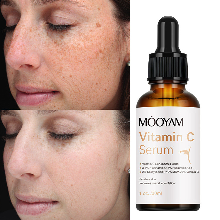 Cuidados com a pele vitamina C essência hidratante vitamina C soro, vitamina C hidratante essência antirrugas – foto na Shopee Brasil